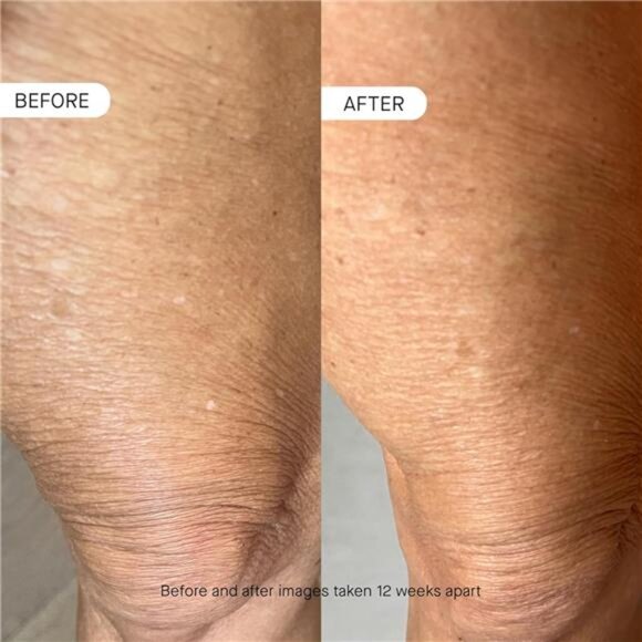 Peptide Skin‎ Longevity Daily Moisturizer  Improves Skin Texture & Barrier - Picture 4 of 6